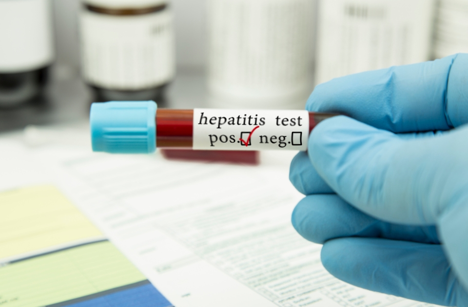 Hepatit B ve hepatit C’nin daha iyi saptanması kanser riskini azaltacaktır