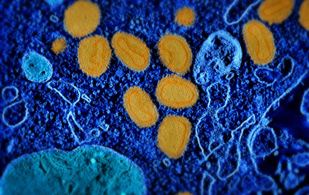 monkeypox-to-be-renamed-mpox-following-recommendation-from-who