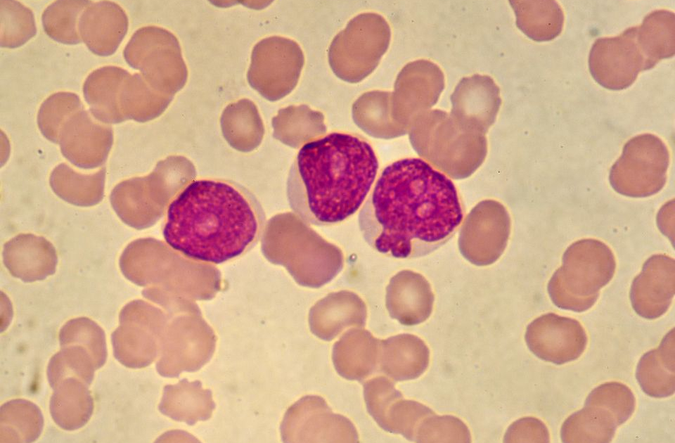 Blood test could make cancer treatments safer and more effective Doherty Website