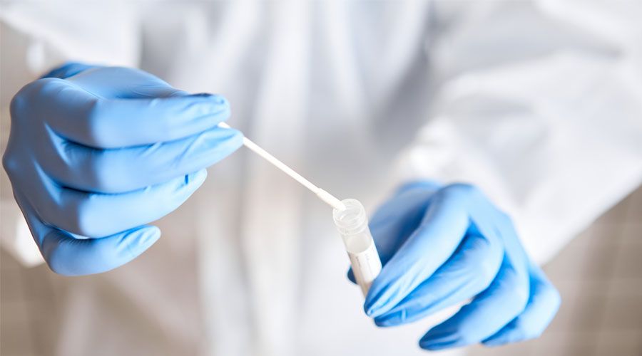 Swab test