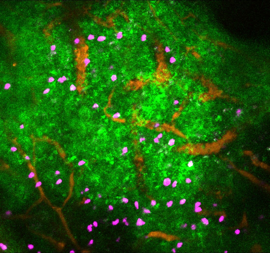 Sympathetic nervous system