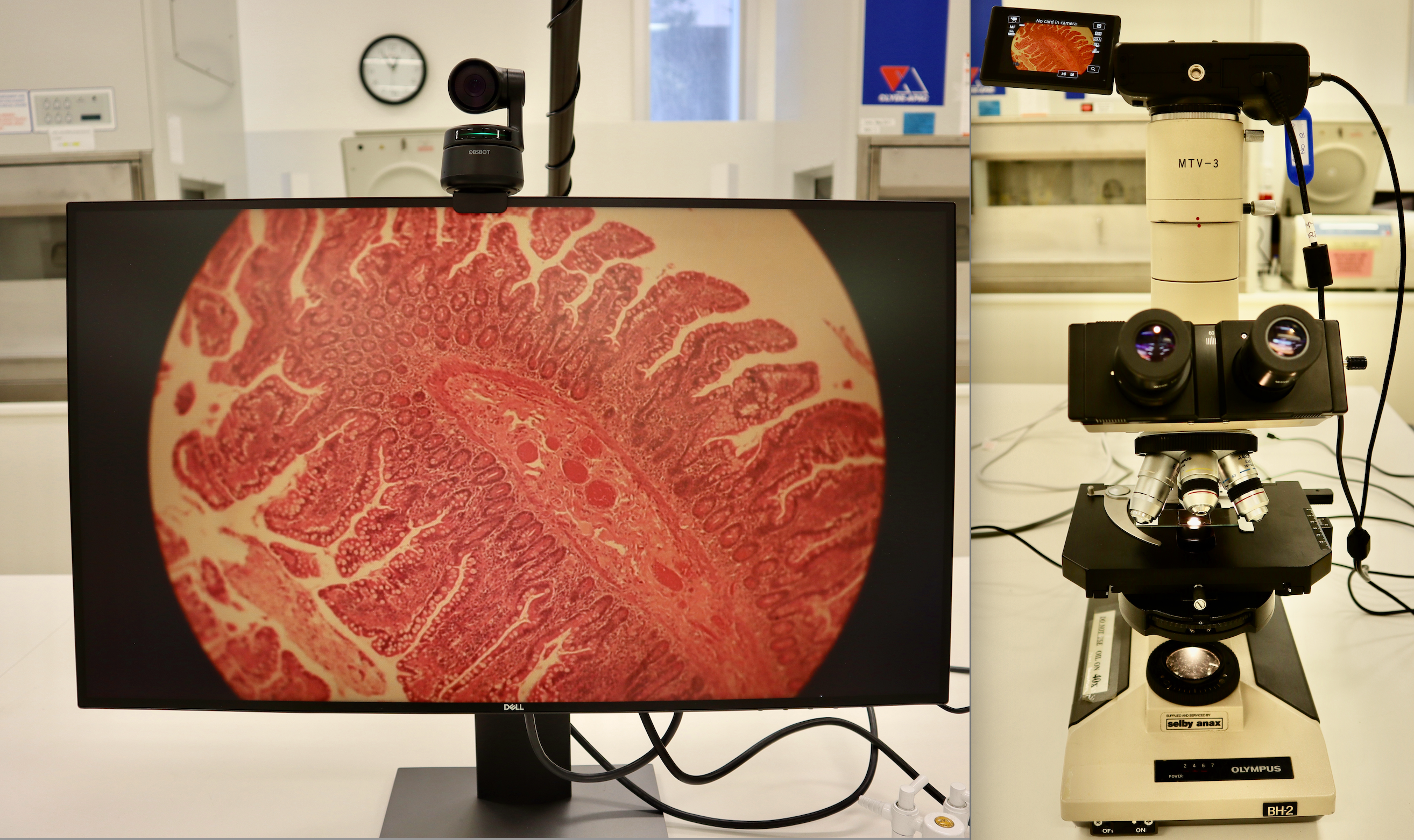 Pathology slide