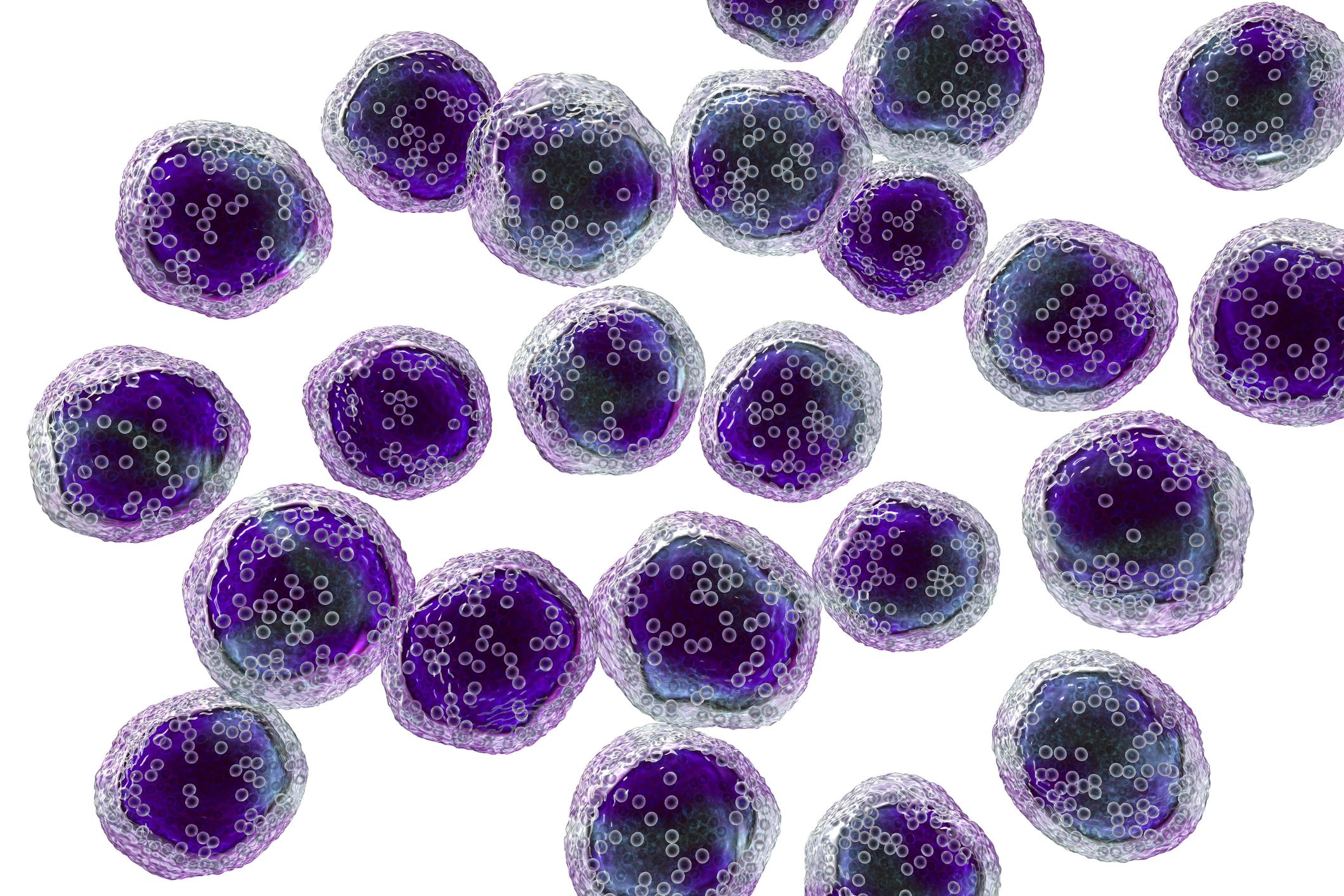 Burkitt's lymphoma cells, a cancer of the lymphatic system, monoclonal B-cell tumor, 3D illustration
