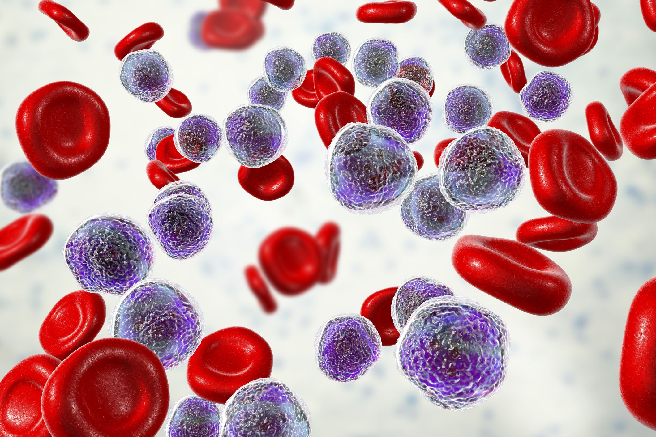 Acute lymphoblastic leukemia, bone marrow smear, 3D illustration
