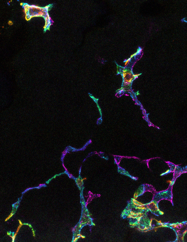 Image of immune cells in the human cornea. Credit:  Dr Holly Chinnery