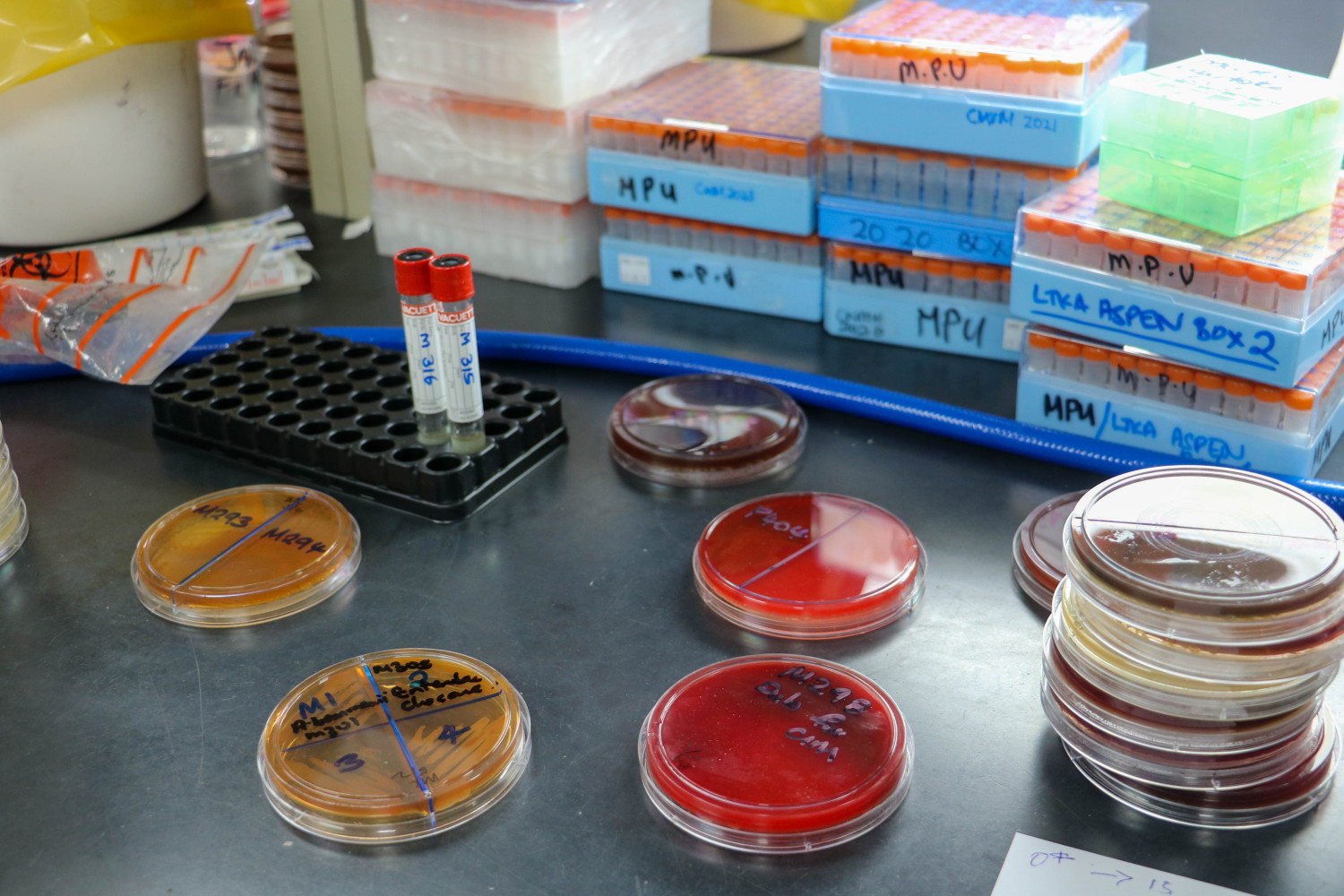Plates used for the screening of AMR pathogens in the microbiology laboratory, Fiji