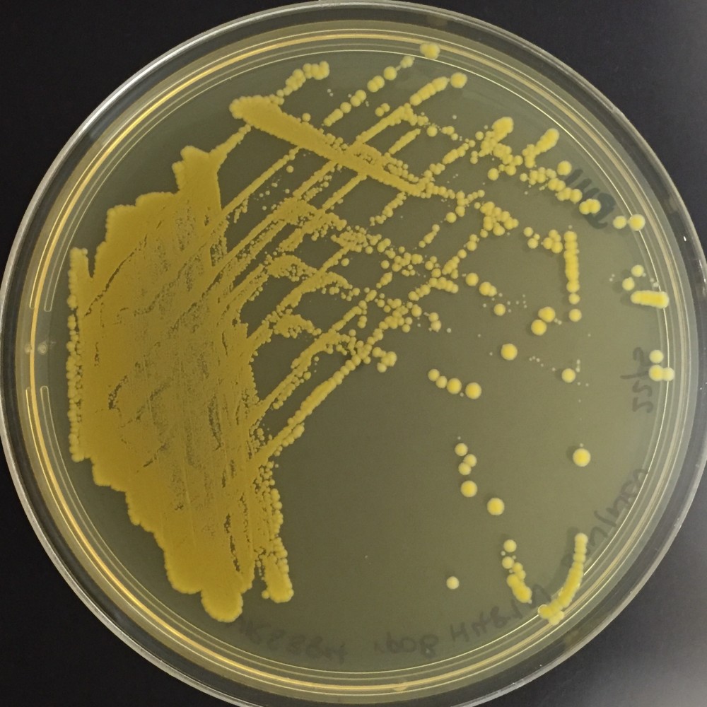 Staphylococcus aureus 3. S. aureus золотистый стафилококк. Бактерий Staphylococcus epidermidis. Золотистый стафилококк эпидермальный. Эпидермальный стафилококк Staphylococcus epidermidis.