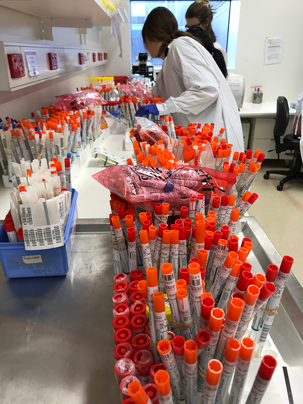 Overflow of COVID-19 samples for testing