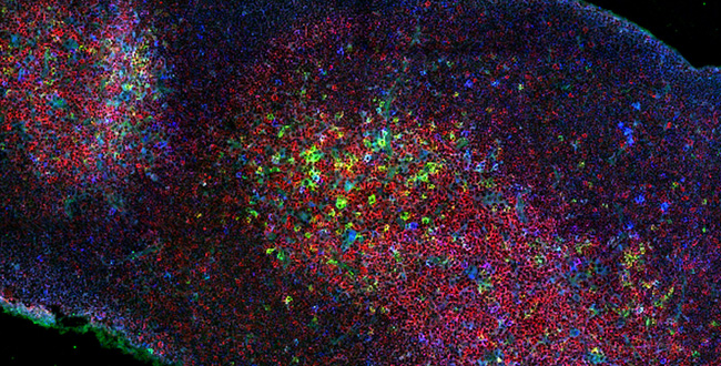 T cells, including innate-like T cell subsets such as Natural Killer T cells and MAIT cells, develop in the thymus from immature precursor cells. Here, the developing T cells (red) and NKT cells (green) can be seen within the thymus. Picture: Darryl Johnson.