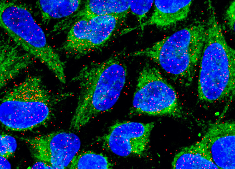 The red dots are the places inside the cells where MR1 captures the newly-developed compound that imitates the bacterial ‘signature’. It is actually the point where these two meet – the molecular interaction. Image credit: Dr Hamish McWilliam.