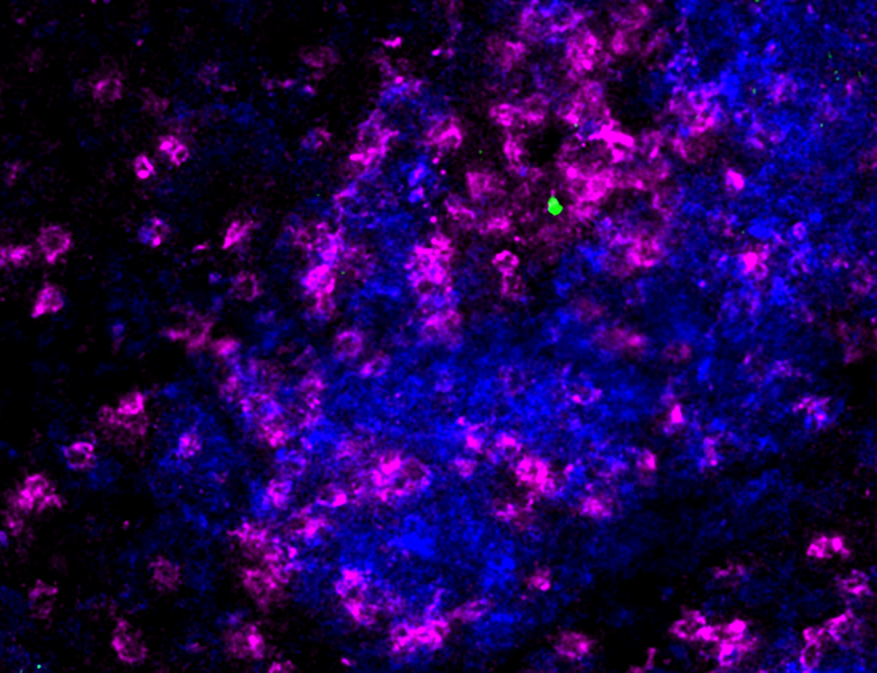 Stem-like T cell taken under microscope. Image credit: Professor Axel Kallies
