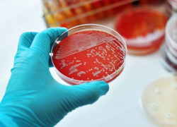 Partnerships to combat Antimicrobial Resistance across the Asia-Pacific