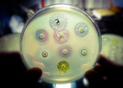 How to slow the spread of deadly ‘superbugs’