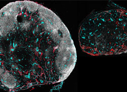 Systemic immune responses can hamper local infection immune responses