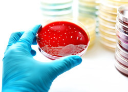 Researchers discover genes behind antibiotic resistance in deadly superbug infections