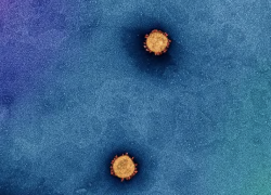 Tracking the COVID-19 pandemic in Australia using genomics