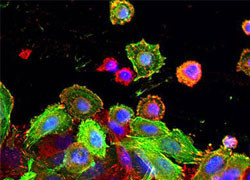 Decoding cancer cell communication