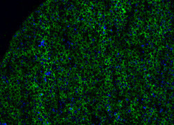 Day of Immunology: Putting the “unconventional” in “unconventional T cell”