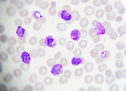 Antibodies help identify women protected from placental malaria