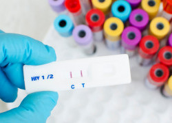 The impact of COVID-19 on HIV research