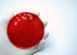 What is antimicrobial resistance and how can we help prevent it?