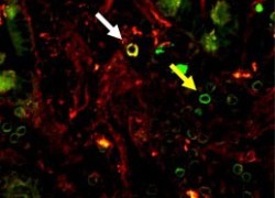 NIH facility provides MR1 tetramers developed at Doherty Institute