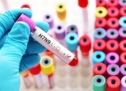 Specific immune cells critical to surviving “bird flu”