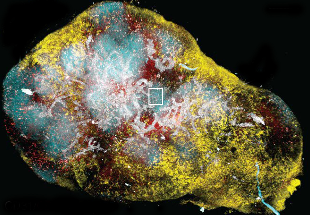 An image of a lymph node that appears in the Cancer Cell paper courtesy of Associate Professor Scott Mueller.