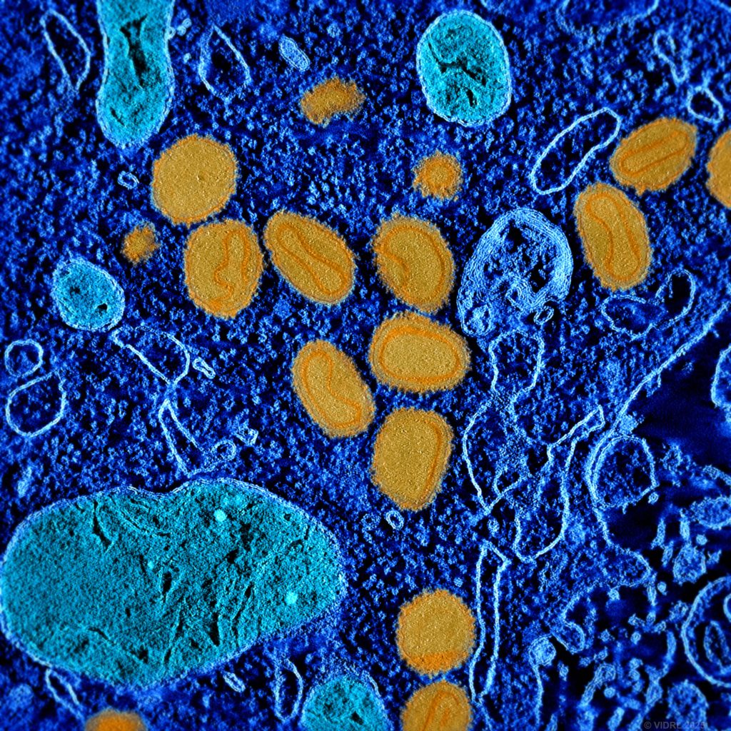 Tem Tomogram From analogue to AI: Half a century of electron microscopy innovation ...